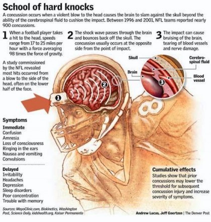 Sports Concussions: A Growing Concern - Space Coast Daily