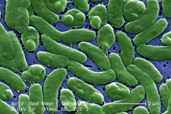 A recent, tragic death that occurred in Volusia County has brought forth  concerns of the bacteria, Vibrio vulnificus – a bacterium that normally lives in warm seawater.  