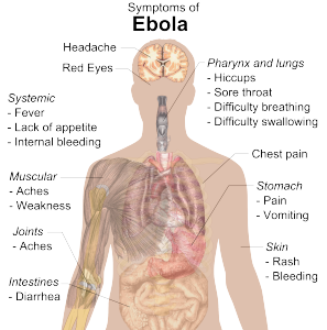 Symptoms_of_ebola