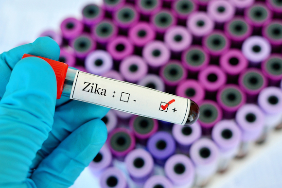 zika testing