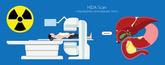 How a HIDA Scan Can Help Your Overall Health Diagnosis - Space Coast Daily