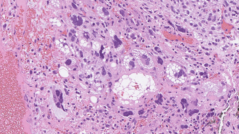 New Technology Featuring Digital Pathology Speeds Critical Diagnoses at Health First